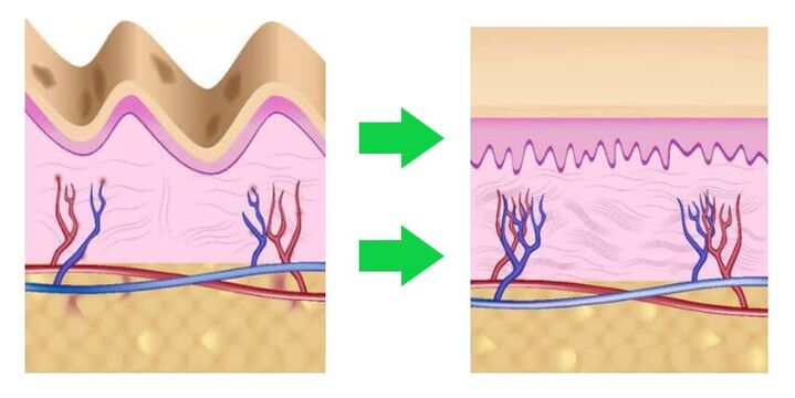 Intenskin align the skin