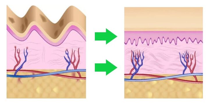 Intenskin evens out skin tone