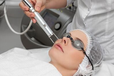 Laser skin rejuvenation benefits